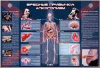 Электрифицированный стенд "Вредные привычки: алкоголизм" - «globural.ru» - Курск