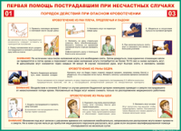 Таблица Порядок действий при опасном кровотечении 1000*1400 винил - «globural.ru» - Курск